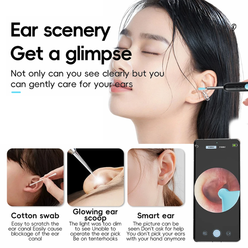 EarCamera HD Ear Camera with Live View