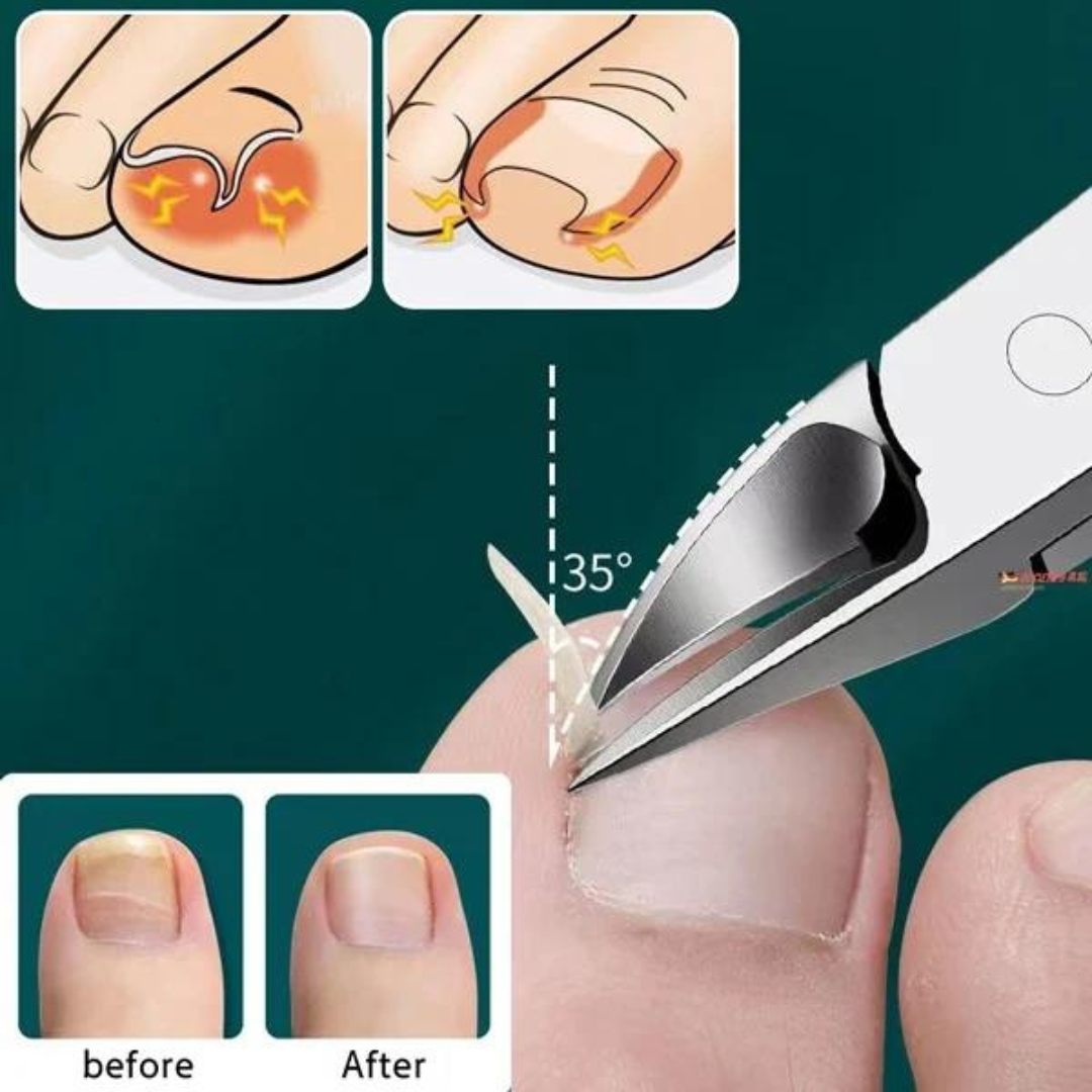 Nipper Professional Nail and Cuticle Nipper