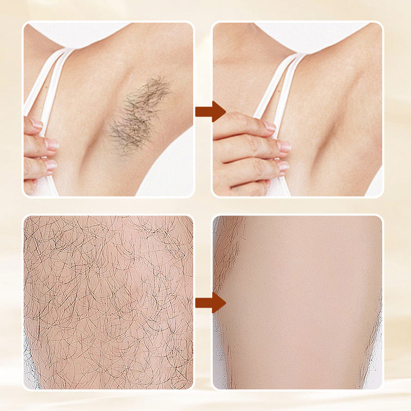 HairErase Gentle Hair Removal Cream
