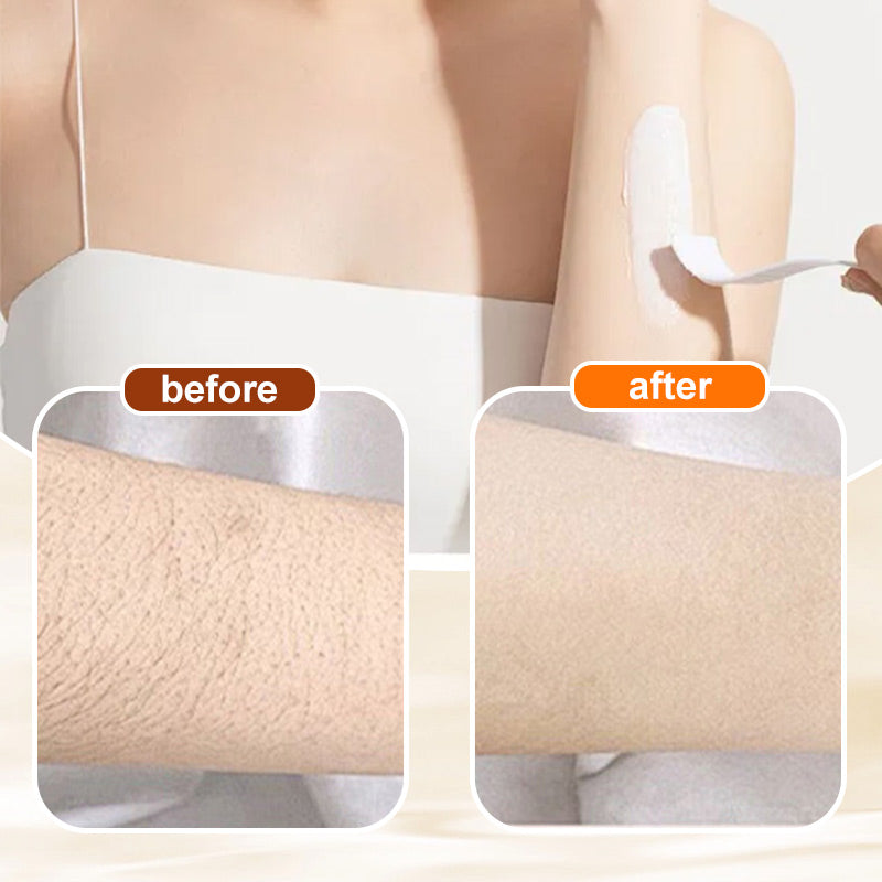 HairErase Gentle Hair Removal Cream